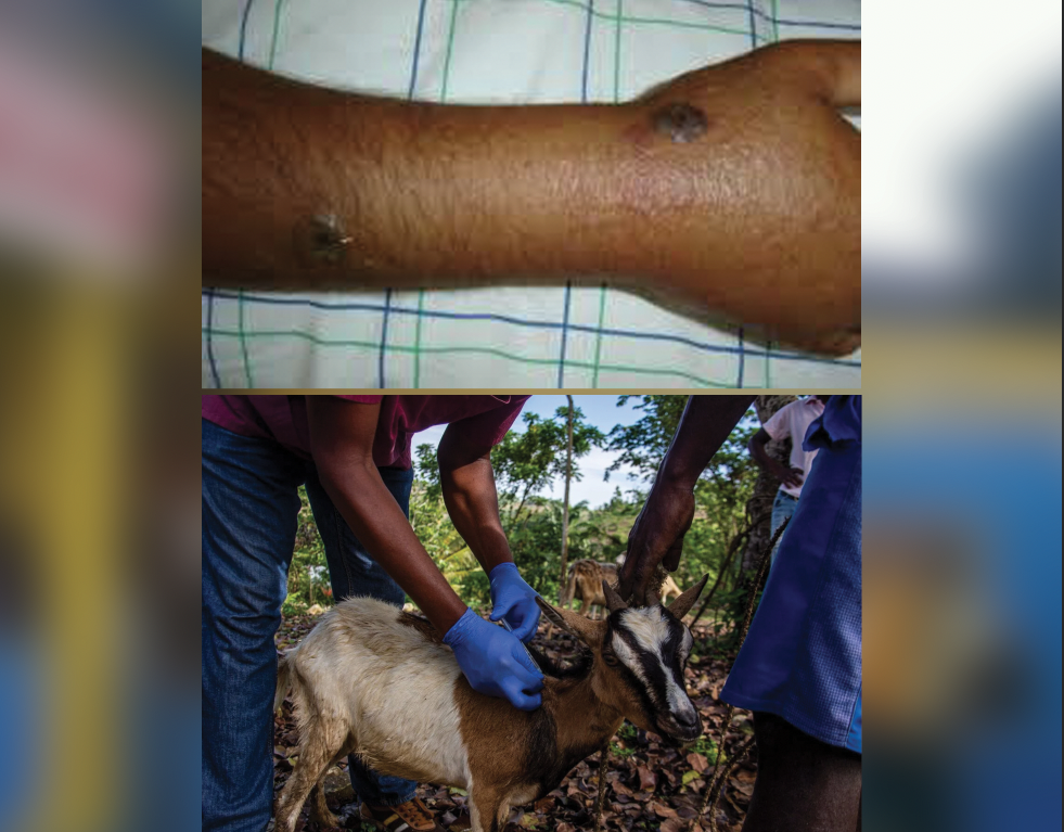 Appel à la prévention dans la lutte contre la maladie du Charbon ou fièvre charbonneuse ou Anthrax en Haïti